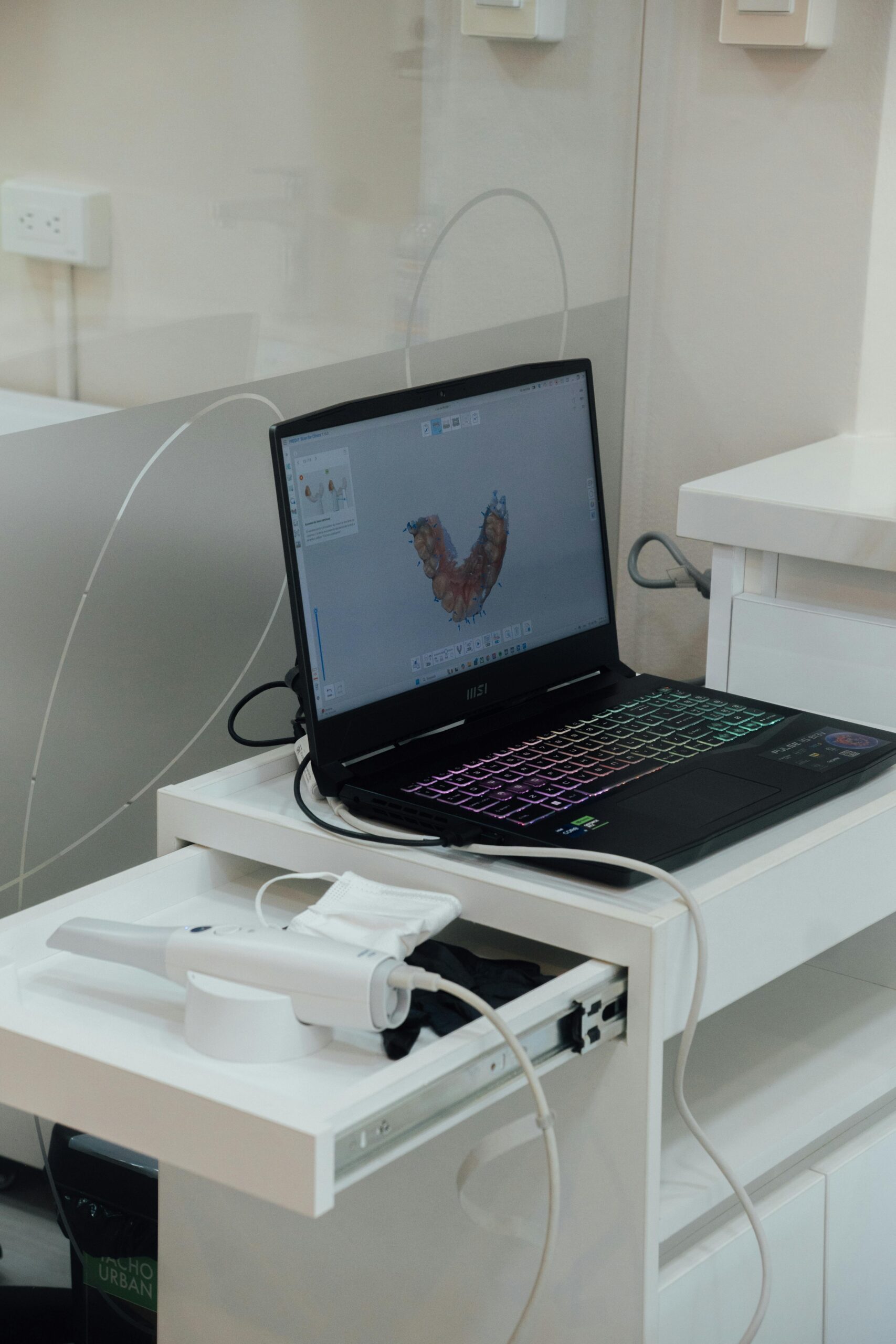 Dental scanning equipment connected to a laptop in a modern clinic setting.